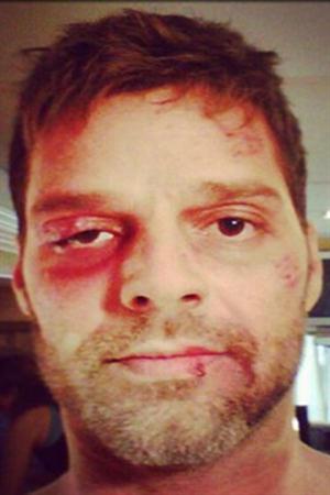Ricky Martin golpeado brutalmente
